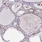 Nucleoporin 188 antibody, NBP2-38936, Novus Biologicals, Immunohistochemistry frozen image 