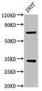 Solute Carrier Family 25 Member 5 antibody, CSB-PA021518LA01HU, Cusabio, Western Blot image 