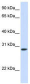 fTnT antibody, TA339175, Origene, Western Blot image 