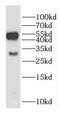 Galactosylceramidase antibody, FNab03306, FineTest, Western Blot image 