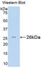 BH3 Interacting Domain Death Agonist antibody, LS-C297530, Lifespan Biosciences, Western Blot image 
