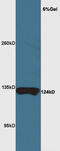 Myelin gene regulatory factor antibody, GTX51055, GeneTex, Western Blot image 