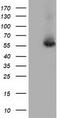 Thromboxane A Synthase 1 antibody, TA501357, Origene, Western Blot image 