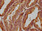 Microtubule Associated Monooxygenase, Calponin And LIM Domain Containing 1 antibody, CSB-PA851555LA01HU, Cusabio, Immunohistochemistry paraffin image 