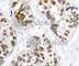 RELB Proto-Oncogene, NF-KB Subunit antibody, AP0240, ABclonal Technology, Immunohistochemistry paraffin image 