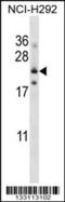 Folate Receptor Gamma antibody, 57-159, ProSci, Western Blot image 