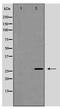 Caveolin 2 antibody, TA348916, Origene, Western Blot image 