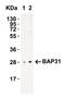 B Cell Receptor Associated Protein 31 antibody, A03767, Boster Biological Technology, Western Blot image 