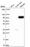 PI3 Kinase p110 beta antibody, NBP2-56397, Novus Biologicals, Western Blot image 