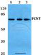 Pericentrin antibody, A03256, Boster Biological Technology, Western Blot image 