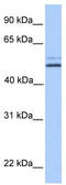Mitochondrial sodium/hydrogen exchanger NHA2 antibody, TA337581, Origene, Western Blot image 