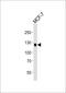 Discoidin Domain Receptor Tyrosine Kinase 1 antibody, M00905-1, Boster Biological Technology, Western Blot image 