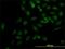 Kinesin Family Member 2C antibody, H00011004-M01, Novus Biologicals, Immunocytochemistry image 