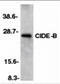 Cell Death Inducing DFFA Like Effector B antibody, 2091, ProSci Inc, Western Blot image 