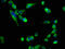 Cholinergic Receptor Nicotinic Beta 2 Subunit antibody, CSB-PA005396LA01HU, Cusabio, Immunofluorescence image 