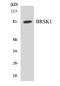 BR Serine/Threonine Kinase 1 antibody, EKC1881, Boster Biological Technology, Western Blot image 