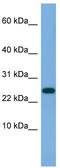 Ankyrin Repeat Domain 39 antibody, TA345024, Origene, Western Blot image 