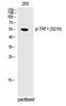 Telomeric Repeat Binding Factor 1 antibody, P02474, Boster Biological Technology, Western Blot image 