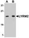LYR Motif Containing 2 antibody, NBP1-77137, Novus Biologicals, Western Blot image 