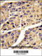 Insulin Like Growth Factor Binding Protein Acid Labile Subunit antibody, 62-941, ProSci, Immunohistochemistry paraffin image 