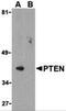 Phosphatidylinositol-3,4,5-trisphosphate 3-phosphatase and dual-specificity protein phosphatase PTEN antibody, 3515, ProSci Inc, Western Blot image 