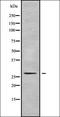 Peroxisomal Biogenesis Factor 11 Alpha antibody, orb338530, Biorbyt, Western Blot image 