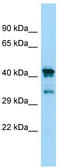 Chitinase Domain Containing 1 antibody, TA331384, Origene, Western Blot image 