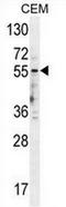 5-Hydroxytryptamine Receptor 3E antibody, AP50002PU-N, Origene, Western Blot image 