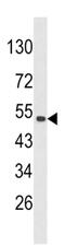 Pleckstrin Homology Domain Containing O1 antibody, MBS9207531, MyBioSource, Western Blot image 