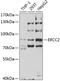 ERCC Excision Repair 2, TFIIH Core Complex Helicase Subunit antibody, 19-771, ProSci, Western Blot image 