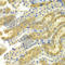 Gamma-PAK antibody, A7333, ABclonal Technology, Immunohistochemistry paraffin image 