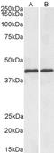 Sterol O-Acyltransferase 1 antibody, LS-C502405, Lifespan Biosciences, Western Blot image 