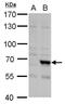 F-Box And Leucine Rich Repeat Protein 4 antibody, PA5-30560, Invitrogen Antibodies, Western Blot image 