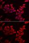 Secreted frizzled-related protein 4 antibody, GTX33493, GeneTex, Immunofluorescence image 