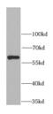 Carboxylesterase 1 antibody, FNab01615, FineTest, Western Blot image 