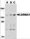 Caspase recruitment domain-containing protein 11 antibody, 3189, ProSci, Western Blot image 