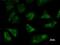 Threonyl-TRNA Synthetase antibody, LS-C342394, Lifespan Biosciences, Immunofluorescence image 