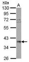 DNA-directed RNA polymerase III subunit RPC6 antibody, GTX105818, GeneTex, Western Blot image 