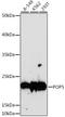 POP5 Homolog, Ribonuclease P/MRP Subunit antibody, A08446, Boster Biological Technology, Western Blot image 