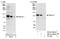 F-Box Protein 11 antibody, NB100-59825, Novus Biologicals, Western Blot image 