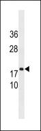 Chromosome 8 Open Reading Frame 44 antibody, LS-C203781, Lifespan Biosciences, Western Blot image 