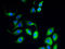 Fetal And Adult Testis Expressed 1 antibody, A66582-100, Epigentek, Immunofluorescence image 