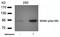 MDM2 Proto-Oncogene antibody, orb15018, Biorbyt, Western Blot image 
