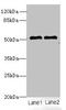 Solute Carrier Family 30 Member 6 antibody, orb32142, Biorbyt, Western Blot image 