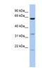 Copine Family Member 9 antibody, NBP1-70508, Novus Biologicals, Western Blot image 