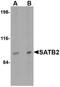 DNA-binding protein SATB2 antibody, NBP1-76912, Novus Biologicals, Western Blot image 