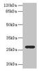 Testis Expressed 35 antibody, CSB-PA732917LA01HU, Cusabio, Western Blot image 