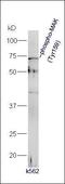 Serine/threonine-protein kinase MAK antibody, orb185427, Biorbyt, Western Blot image 