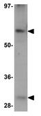 ADAMTS Like 5 antibody, GTX85191, GeneTex, Western Blot image 