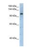 Pre-MRNA Processing Factor 6 antibody, NBP1-57544, Novus Biologicals, Western Blot image 